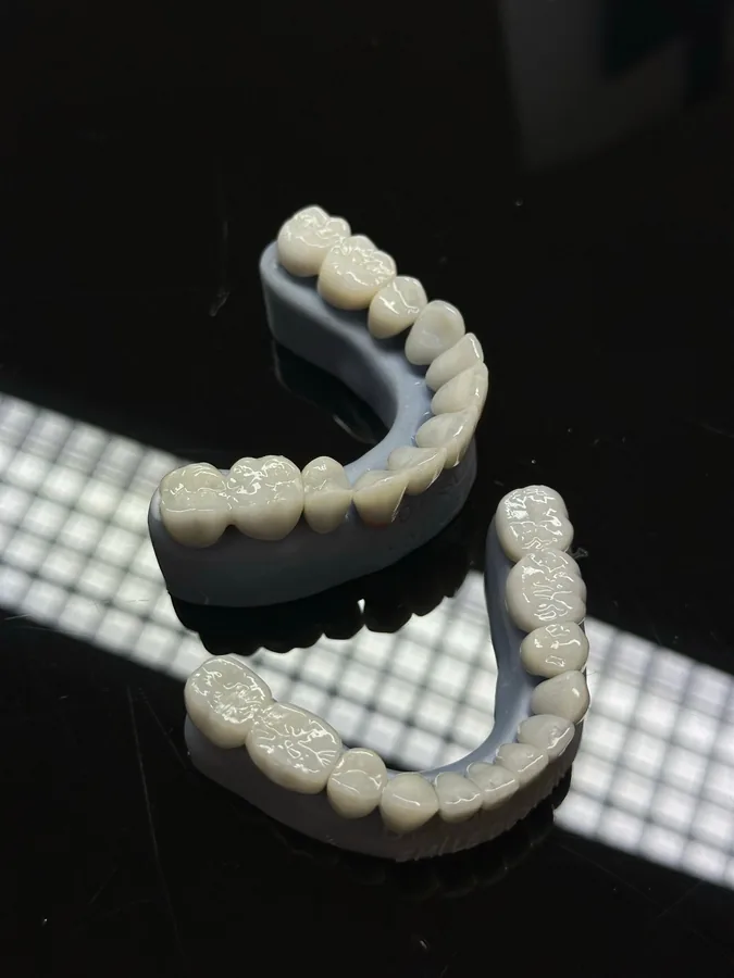Prosthodontic restorative care at Silwadi Dental Center Abu Dhabi