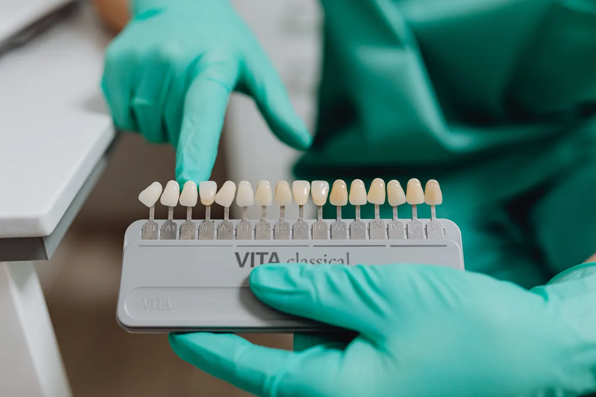 Teeth Whitening dental care at Silwadi Dental Center Abu Dhabi